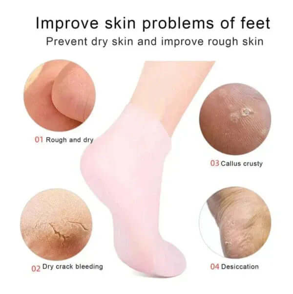 1 Pair Silicone Socks Moisturizing Gel Heel